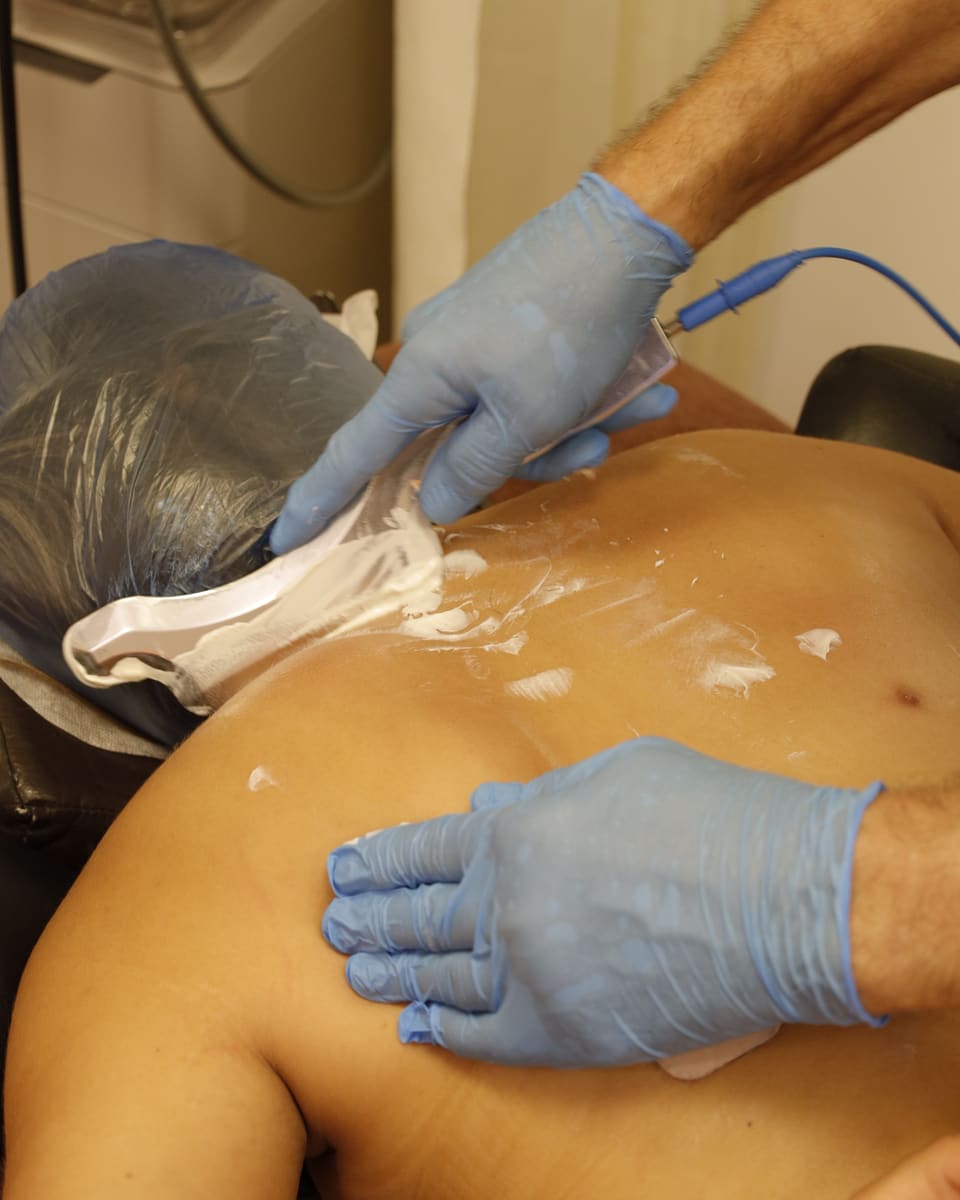A clinician applying therapeutic ultrasound to a patient's upper back with both hands gloved.